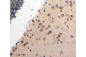Used in DAB staining on fromalin fixed paraffin-embedded Brain tissue (ATR 抗体  (AA 2353-2644))