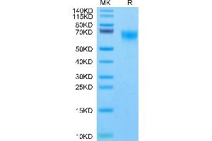 FGFR4 Protein (AA 22-369) (His tag)