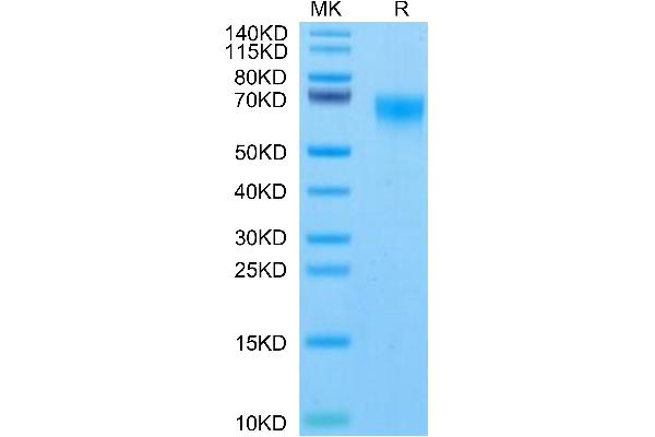 FGFR4 Protein (AA 22-369) (His tag)