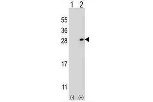 Western blot analysis of FGF9 (arrow) using rabbit polyclonal FGF9 Antibody (N-term) . (FGF9 抗体  (N-Term))