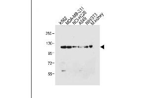 All lanes : Anti-ROR1 Antibody at 1:4000 dilution Lane 1: K562 whole cell lysate Lane 2: MDA-MB-231 whole cell lysate Lane 3: NCI- whole cell lysate Lane 4: A549 whole cell lysate Lane 5: NIH/3T3 whole cell lysate Lane 6: Mouse kidney tissue lysate Lysates/proteins at 20 μg per lane. (ROR1 抗体)