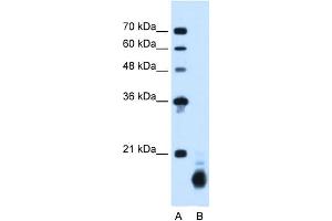 WB Suggested Anti-PPIB Antibody Titration:  1. (PPIB 抗体  (C-Term))
