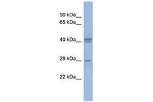 Image no. 1 for anti-CCAAT/enhancer Binding Protein (C/EBP), delta (CEBPD) (C-Term) antibody (ABIN6742779) (CEBPD 抗体  (C-Term))