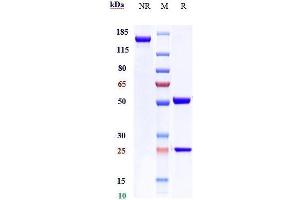 Anti-MADCAM1 Reference Antibody (ontamalimab) on SDS-PAGE under reducing (R) condition.