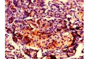Immunohistochemistry of paraffin-embedded human pancreatic tissue using ABIN7167217 at dilution of 1:100 (RAB1A 抗体  (AA 1-196))