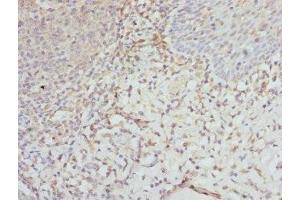 Immunohistochemistry of paraffin-embedded human tonsil tissue using ABIN7152135 at dilution of 1:100