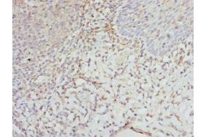 Immunohistochemistry of paraffin-embedded human tonsil tissue using ABIN7152135 at dilution of 1:100 (EIF2S3 抗体  (AA 173-472))