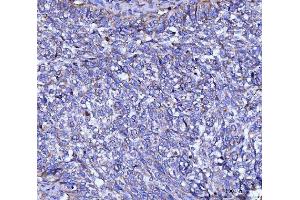 IHC analysis of CYB5B using anti-CYB5B antibody (ABIN7600312).