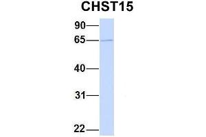 Host:  Rabbit  Target Name:  CHST15  Sample Type:  MCF7  Antibody Dilution:  1.