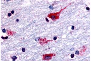 Anti-CHRM2 antibody  ABIN1048440 IHC staining of human brain, neurons and glia. (Muscarinic Acetylcholine Receptor M2 抗体  (Cytoplasmic Domain))