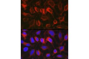 Immunofluorescence analysis of HeLa cells using G6PD Rabbit pAb (ABIN3022094, ABIN3022095, ABIN3022096 and ABIN6218601) at dilution of 1:100 (40x lens). (Glucose-6-Phosphate Dehydrogenase 抗体  (AA 246-545))