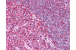 Immunohistochemistry (IHC) image for anti-Heat Shock 70kDa Protein 8 (HSPA8) (N-Term) antibody (ABIN2783375) (Hsc70 抗体  (N-Term))
