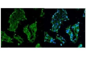 IHC analysis of RCC1 using anti-RCC1 antibody (ABIN7600024). (RCC1 抗体  (AA 14-421))