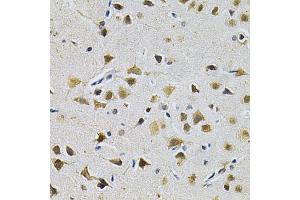 Immunohistochemistry of paraffin-embedded rat brain using LGALS3 Antibody (ABIN5970683) at dilution of 1/200 (40x lens). (Galectin 3 抗体)