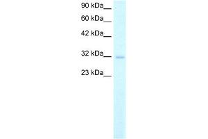 WB Suggested Anti-MSX1 Antibody Titration: 2. (MSX1 抗体  (Middle Region))