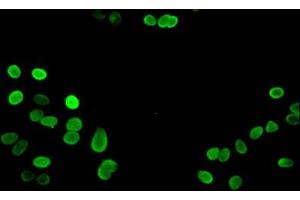Immunofluorescent analysis of Hela cells using ABIN7139668 at dilution of 1:100 and Alexa Fluor 488-congugated AffiniPure Goat Anti-Rabbit IgG(H+L) (HIST1H3A 抗体  (3meLys27))