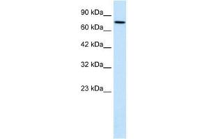 WHSC1 antibody used at 1. (WHSC1 抗体  (N-Term))