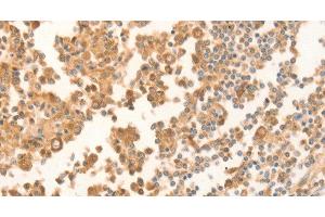 Immunohistochemistry of paraffin-embedded Human tonsil using NAP1L1 Polyclonal Antibody at dilution of 1:70 (NAP1L1 抗体)