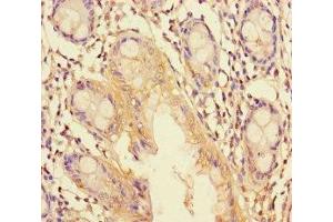 Immunohistochemistry of paraffin-embedded human colon tissue using ABIN7151266 at dilution of 1:100 (TRIM37 抗体  (AA 301-600))