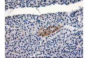 Immunohistochemical staining of paraffin-embedded Human pancreas tissue using anti-TBC1D21 mouse monoclonal antibody. (TBC1D21 抗体)