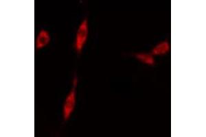 Immunofluorescence (fixed cells) (IF/ICC) image for anti-MYST Histone Acetyltransferase 2 (MYST2) (Internal Region) antibody (ABIN6257254)