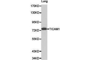 Western Blotting (WB) image for anti-Toll-Like Receptor Adaptor Molecule 1 (TICAM1) antibody (ABIN1875095) (TICAM1 抗体)