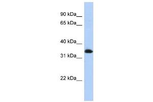 WB Suggested Anti-ZNF511 Antibody Titration:  0. (ZNF511 抗体  (N-Term))