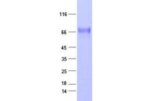 Validation with Western Blot