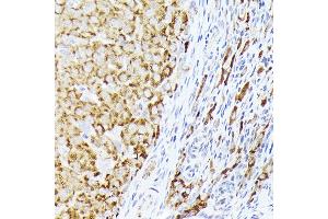 Immunohistochemistry of paraffin-embedded rat ovary using BMPR1B Rabbit pAb (ABIN3022719, ABIN3022720, ABIN3022721, ABIN1512645 and ABIN6219169) at dilution of 1:350 (40x lens).