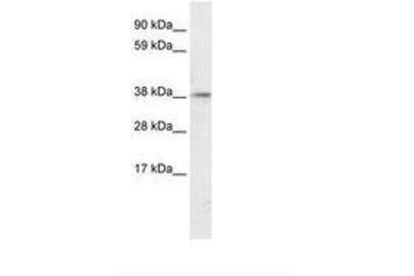 PSMD11 抗体  (AA 276-325)