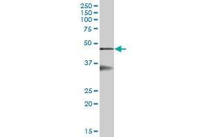 Western Blotting (WB) image for anti-serpin Peptidase Inhibitor, Clade B (Ovalbumin), Member 6 (SERPINB6) (AA 1-376) antibody (ABIN518870)