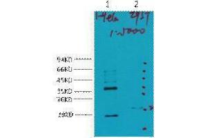 Western Blotting (WB) image for anti-Carbonic Anhydrase IX (CA9) antibody (ABIN3181146) (CA9 抗体)