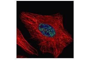 ICC/IF Image Confocal immunofluorescence analysis (Olympus FV10i) of paraformaldehyde-fixed HeLa, using WTAP, antibody (Green) at 1:500 dilution. (WTAP 抗体  (Center))