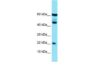 Host: Rabbit Target Name: PLA2G12B Sample Type: HT1080 Whole Cell lysates Antibody Dilution: 1. (PLA2G12B 抗体  (N-Term))