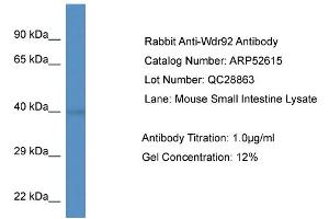Western Blotting (WB) image for anti-WD Repeat Domain 92 (WDR92) (Middle Region) antibody (ABIN2785012) (WDR92 抗体  (Middle Region))