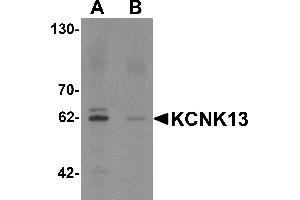 Western blot analysis of KCNK13 in rat brain tissue lysate with KCNK13 antibody at 0. (KCNK13 抗体  (Middle Region))