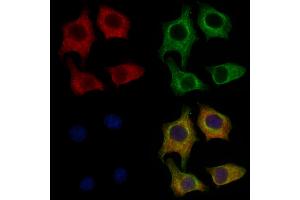 ABIN6262456 and ABIN6278877 staining HepG2 cells by IF/ICC.