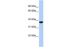 Western Blotting (WB) image for anti-Exosome Component 2 (EXOSC2) antibody (ABIN2458529) (EXOSC2 抗体)