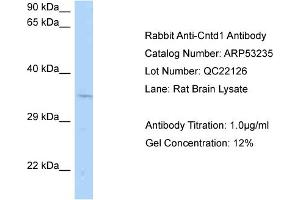 Western Blotting (WB) image for anti-Cyclin N-terminal Domain Containing 1 (CNTD1) (Middle Region) antibody (ABIN2785305) (CNTD1 抗体  (Middle Region))