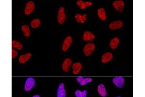 Confocal immunofluorescence analysis of U-2 OS cells using METTL3 Polyclonal Antibody at dilution of 1:200. (METTL3 抗体)