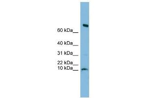 C1orf122 antibody used at 1 ug/ml to detect target protein. (C1orf122 抗体  (N-Term))
