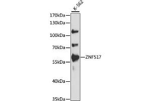 Western blot analysis of extracts of K-562 cells, using ZNF517 antibody (ABIN7271495) at 1:1000 dilution.
