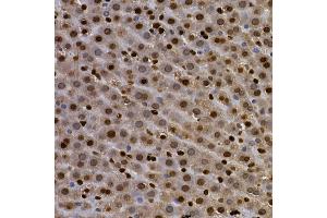 Immunohistochemistry of paraffin-embedded rat lung using AHR Rabbit pAb (ABIN3015499, ABIN3015500, ABIN5663909 and ABIN6218543) at dilution of 1:100 (40x lens). (Aryl Hydrocarbon Receptor 抗体  (AA 619-848))