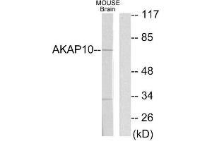 Western Blotting (WB) image for anti-A Kinase (PRKA) Anchor Protein 10 (AKAP10) (N-Term) antibody (ABIN1848976) (AKAP10 抗体  (N-Term))