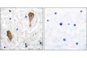 Immunohistochemistry analysis of paraffin-embedded human brain tissue, using GAD1 Antibody. (GAD 抗体  (AA 471-520))