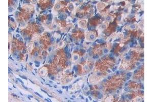 Detection of IL2Rg in Mouse Stomach Tissue using Polyclonal Antibody to Interleukin 2 Receptor Gamma (IL2Rg) (IL2RG 抗体  (AA 23-263))