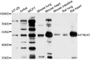 Western blot analysis of extracts of various cell lines, using IFNLR1 antibody (ABIN6003788) at 1/1000 dilution. (IL28RA 抗体)