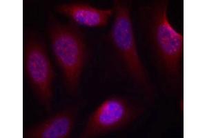 Immunofluorescence staining of methanol-fixed Hela cells using SEK1/MKK4(Phospho-Ser80) Antibody. (MAP2K4 抗体  (pSer80))