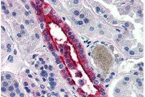 Human Kidney (formalin-fixed, paraffin-embedded) stained with AQP2 antibody ABIN290706 at 20 ug/ml followed by biotinylated goat anti-rabbit IgG secondary antibody ABIN481713, alkaline phosphatase-streptavidin and chromogen. (AQP2 抗体  (N-Term))