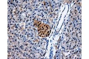 Immunohistochemical staining of paraffin-embedded Kidney tissue using anti-PSMC3mouse monoclonal antibody. (PSMC3 抗体)